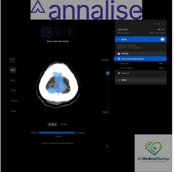 ai-solution-for-non-contrast-head-ct-studies
