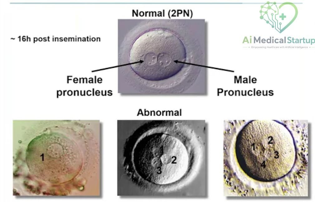 fertilization-assessment
