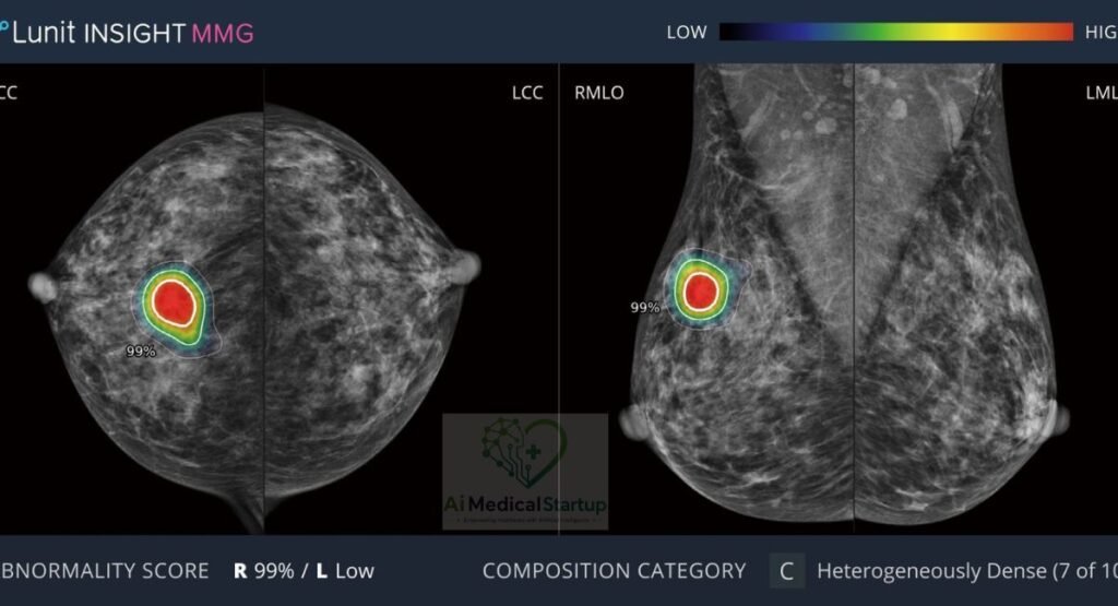 lunit-associated-with-chest-and-breast-imaging