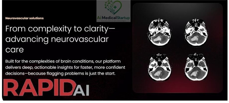 rapidai-specializes-in-stroke-and-neurovascular-care